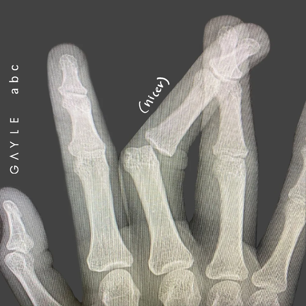 Album cover for ABCDEFU by Gayle